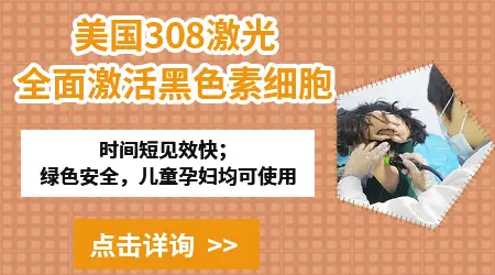 孕妇长白癜风能照308激光治疗吗