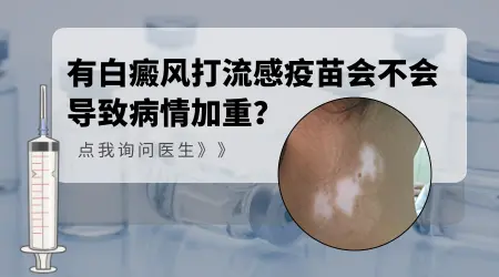 白癜风能不能打流感疫苗