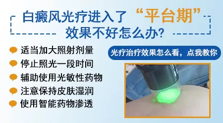 为什么白癜风照光后期效果变慢了