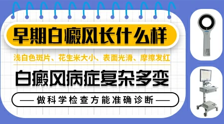 屁股白斑的早期症状图片