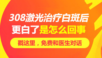 白癜风照308后白斑更白了