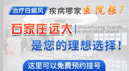 石家庄哪个医院看身上白斑好