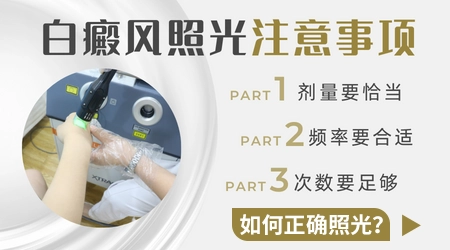 什么类型的白癜风照激光比较有效
