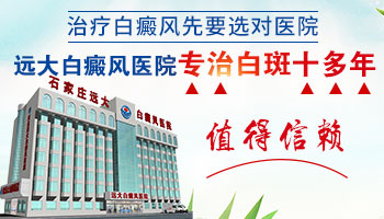 白癜风治疗一年了还没好还需要坚持吗