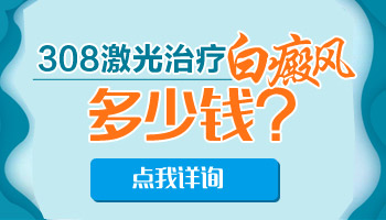 白癜风308激光一次多少钱