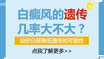 手指头的第一个关节有白癜风不太明显会遗传吗