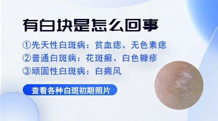 肚子有白斑怎么回事
