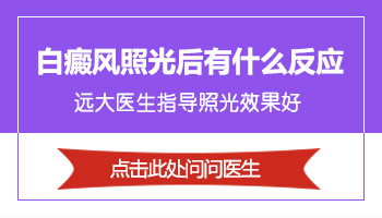 白癜风患者用了光疗后有哪些反应