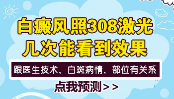 指甲大的白斑做几次308才能好