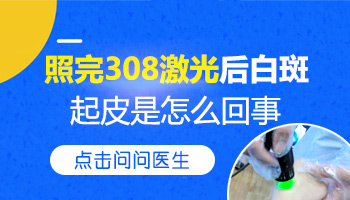 308准分子激光治疗起皮可以抠掉吗