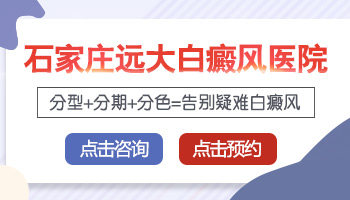 局限型白癜风治疗一般需要多久