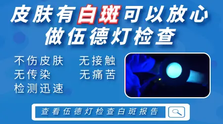 确诊皮肤白斑需要做哪些检查