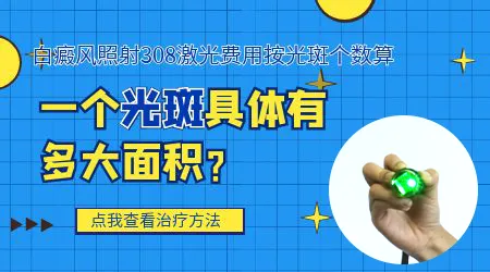 白癜风光疗多久能好 治疗费用大概多少