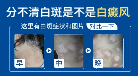 腿上出现了一些白斑块