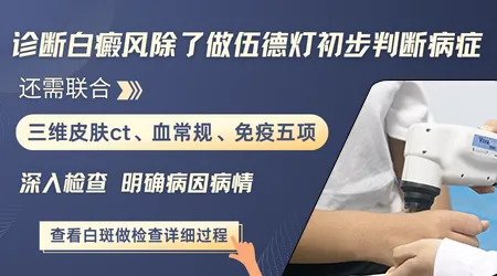 检测白斑做伍德灯后有必要做皮肤CT吗