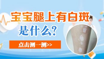 宝宝大腿上有白斑是什么病