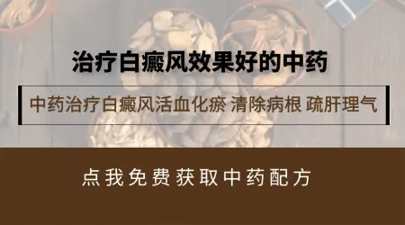 中药治疗白癜风有没有效果
