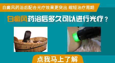 全身舱治好白癜风的概率有多大