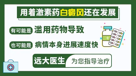 吃激素都没有控制白癜风怎么办