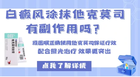 乳头黏膜白斑可以擦他克莫司软膏吗