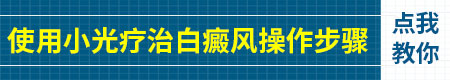 家用光疗机照白癜风多久能照好