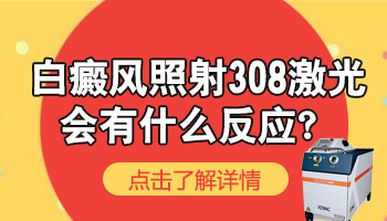 白斑照308激光反应太大正常吗