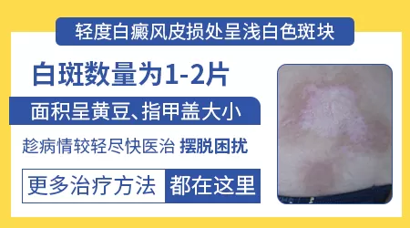 早期白癜风症状表现