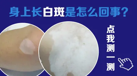 腿上胳膊上都长有小白点怎么回事