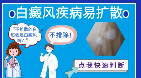 白癜风早期症状有哪些表现