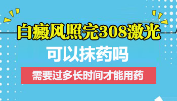 白癜风做完308后多长时间可以涂药