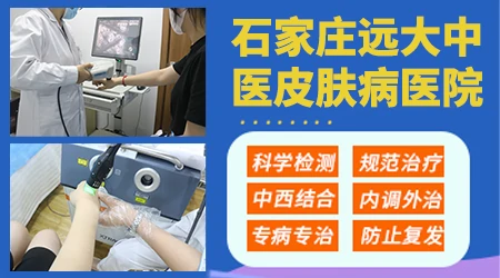 石家庄治疗白癜风有名的专家推荐