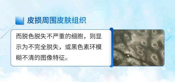 北京专家来啦！！特邀北京白癜风专家——苏有明教授将于4月5日来院会诊