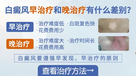 白癜风初期好不好治 怎么治疗好