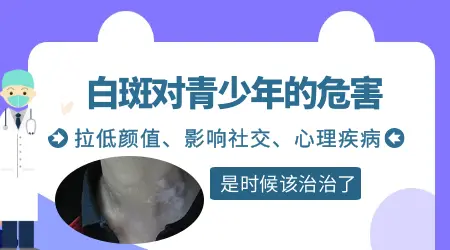 青少年长白斑原因 白斑影响上大学吗