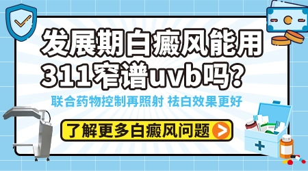 311光疗照光治疗白癜风中间间隔多久