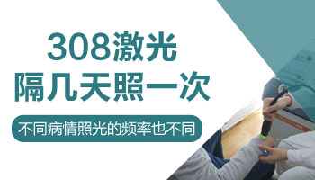 白癜风可不可以天天做308激光