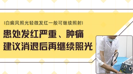 小型家用光疗机治白癜风恢复图