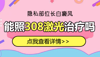 隐私部位有白癜风可以用308照光吗