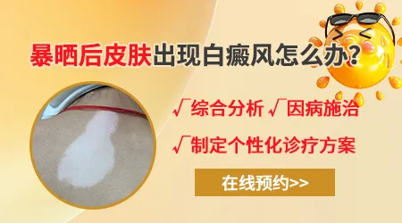 皮肤暴晒后变红然后白一块怎么办
