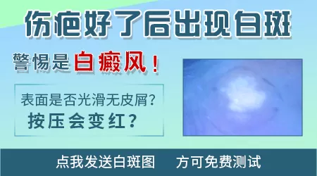 额头上磕伤留下白斑