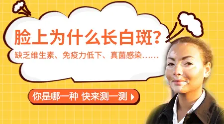 脸上白斑一定是白癜风吗