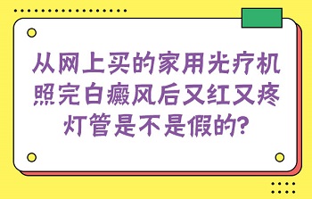 网上买的308激光照白癜风有没有用