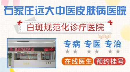 检查白斑是不是白癜风做哪些检查