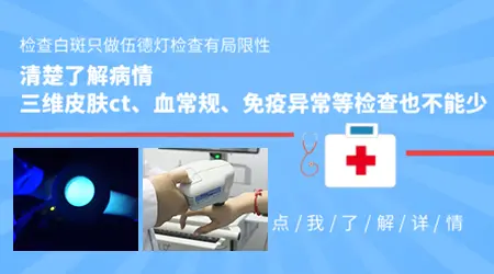 检查白斑伍德灯显示有荧光什么意思
