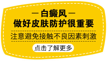 手部白癜风会向面部扩散吗