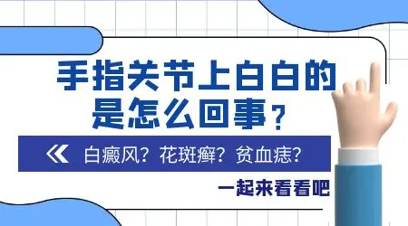 手指关节有白斑是白癜风吗