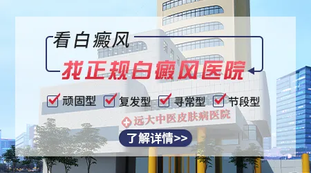 石家庄哪家医院治疗白癜风权威