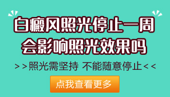 窄普uvb一周照射白癜风一次行吗