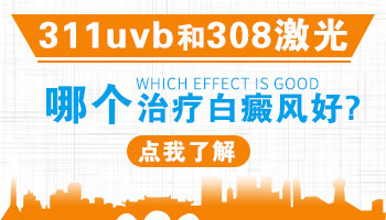 治疗白癜风311和308激光怎么选