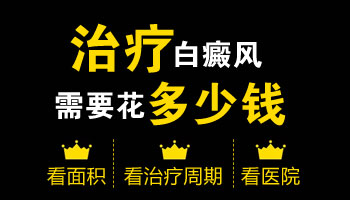 初次治疗白癜风的费用大概需要多少